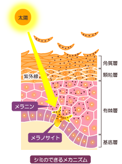 シミのできるメカニズム